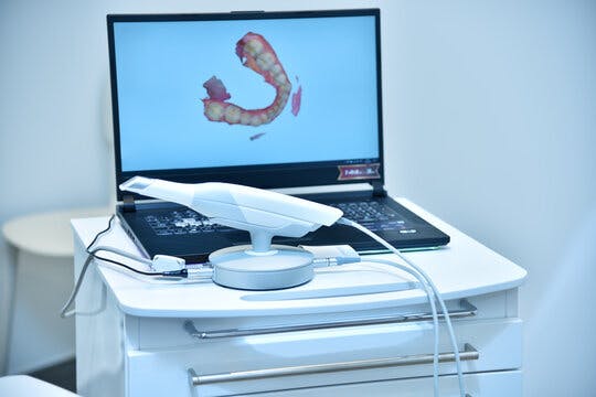 intraoral scanner